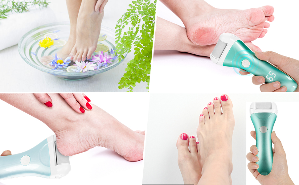 Nicebirdie professional multifunctional electric foot callus remover