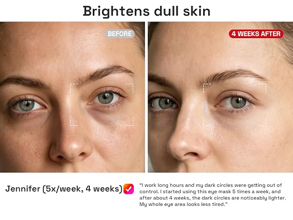 Brightens dull skin