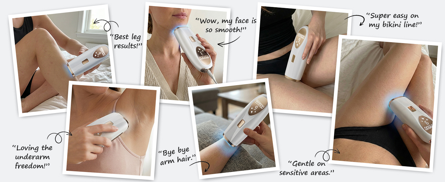 laser hair removal device
