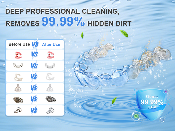 ultrasonic retainer cleaner