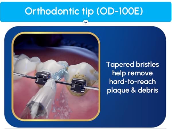 Image of Orthodontic Flossing tip with text reading tapered bristles to remove hard to reach plaque.