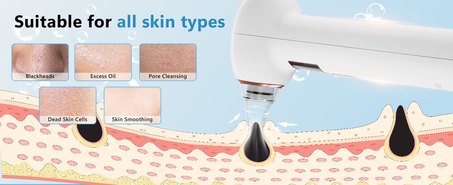 Suitable for all skin types