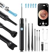 Loyker X6 Ear Wax Removal Tool Camera, Ear Cleaner with Camera, FSA - HSA Store Eligible, 1080P E...