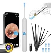 Ear Wax Removal, Ear Cleaner with Camera with 1080P, Ear Wax Removal Tool with 6 LED Light, Ear W...