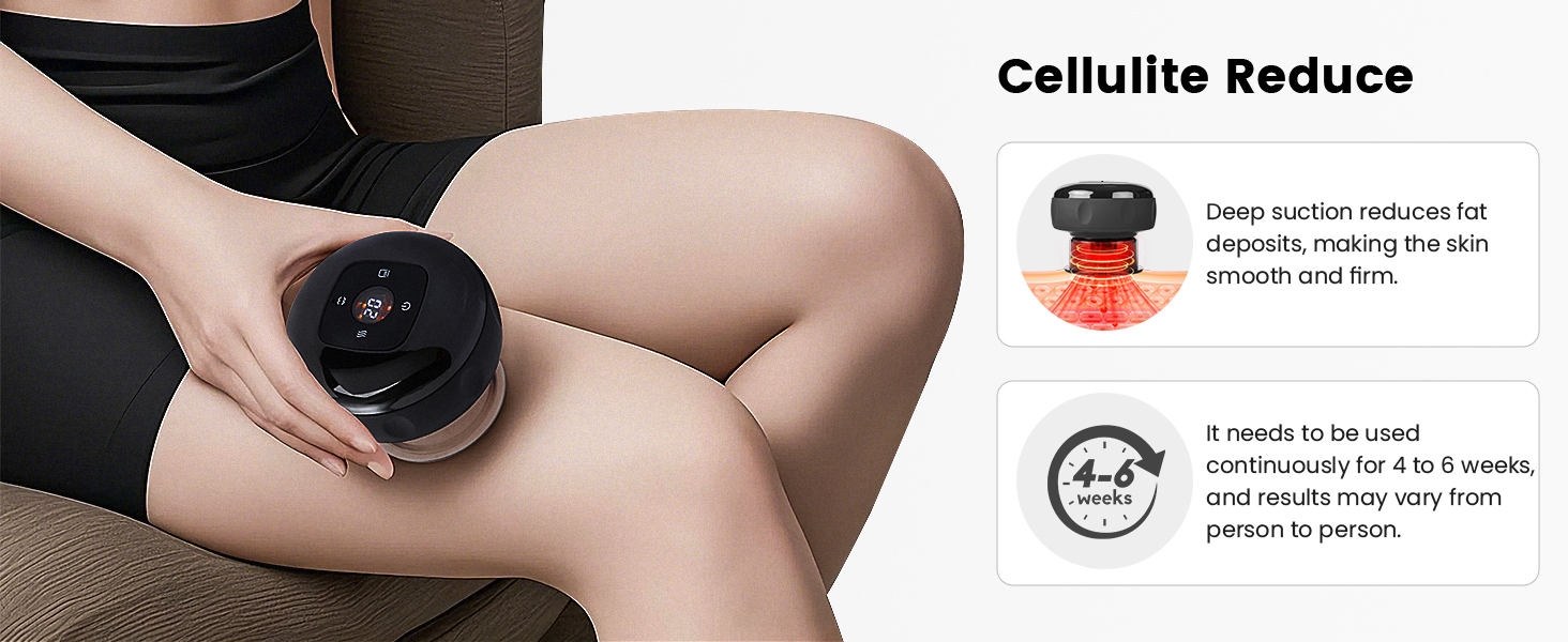 cupping kit for massage therapy