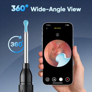 ear wax removal