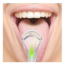 oral hygiene