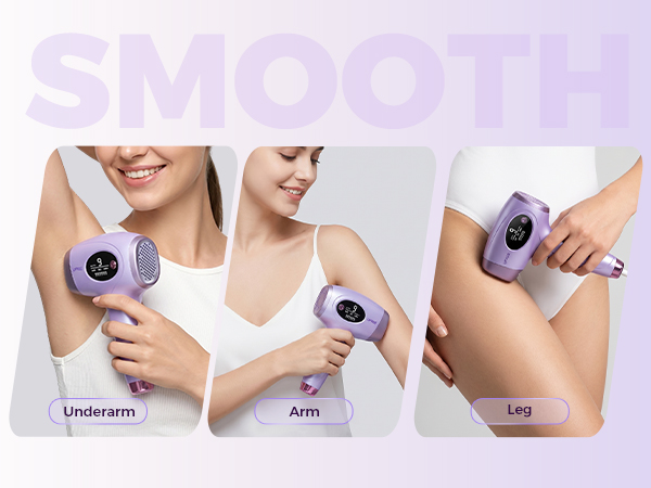 laser hair removal