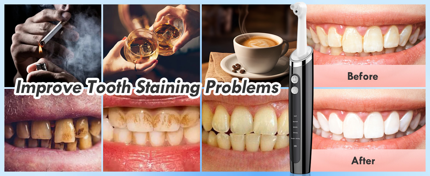 tartar remover for teeth