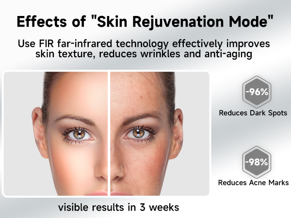 laser hair removal for women