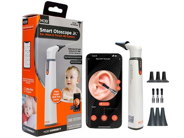 MOBI Smart Otoscope Jr. - High-Definition Digital Otoscope for ENT Exams