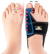 INDEEMAX Bunion Corrector for Women Men, Adjustable Orthopedic Bunion Splint, Non-Surgical Big To...