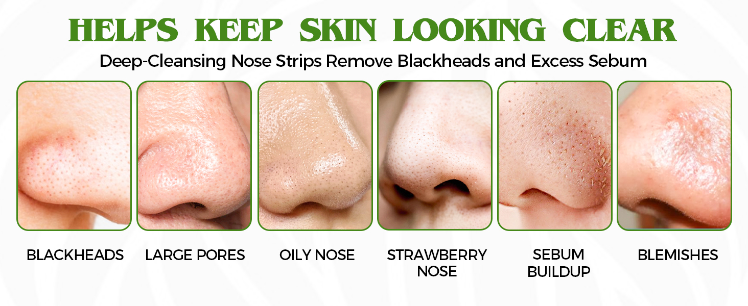 blackhead remover strips