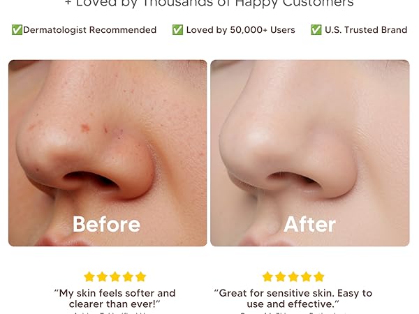 Facial Cleansing Brush