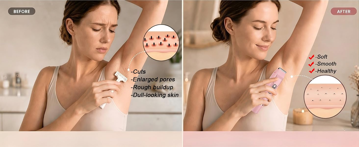 bikini trimmer for women