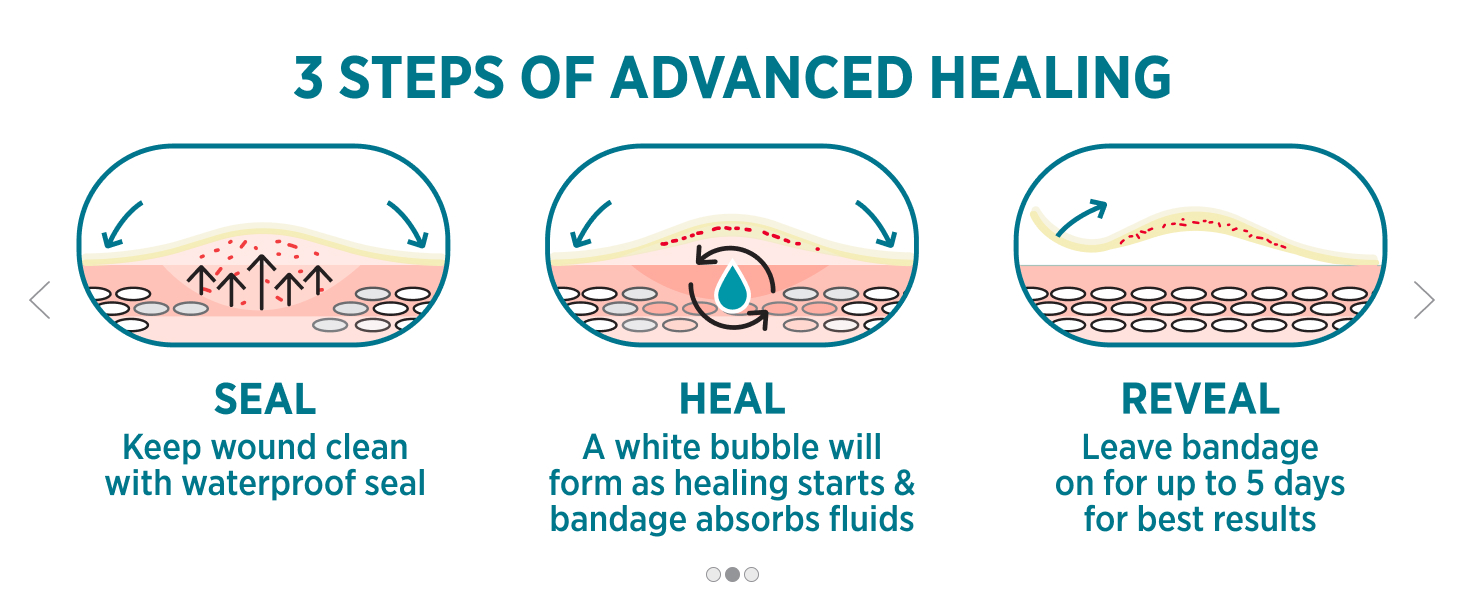 Advanced Healing with Hydrocolloid Bandages