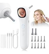 Otoscope Ear Camera with 1.21” Screen, 1080P Ear Scope with 4 LED Lights, Otoscope Camera for Adu...