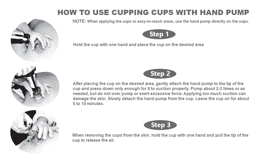 How to Use Cupping Cups with Hand Pump