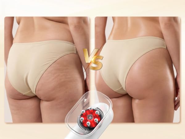 Body Sculpting Machine