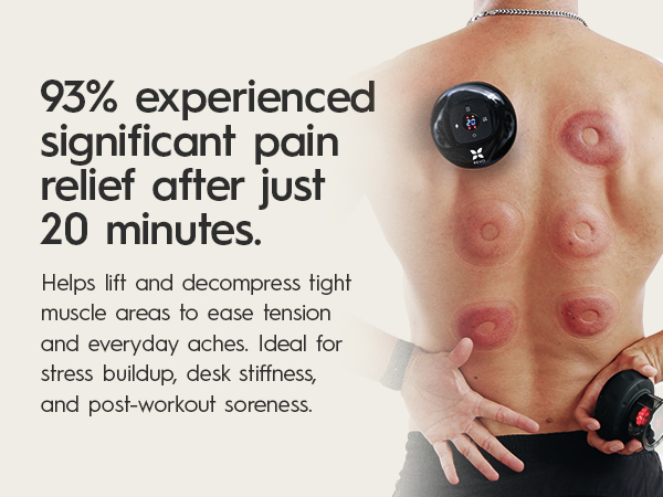 93% reported significant pain relief after a 20 minute session
