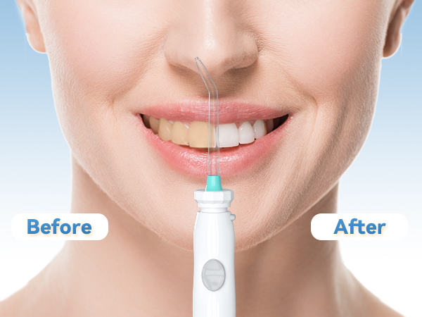 BEFORE-AFTER