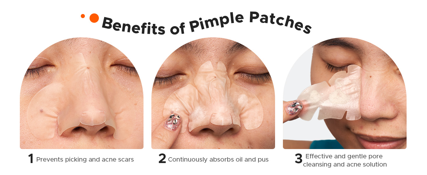 Benefits of Pimple Patches
