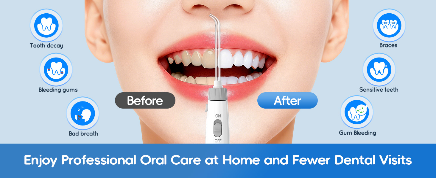 irrigador dental