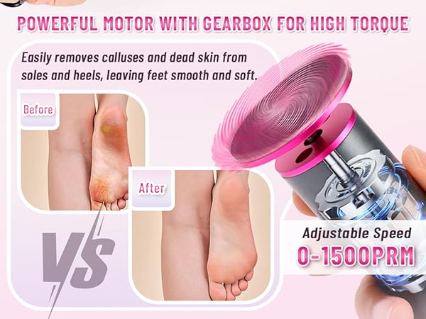 electric foot callus remover