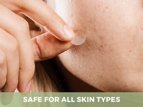 pimple patches, acne patches, pimple patches for face