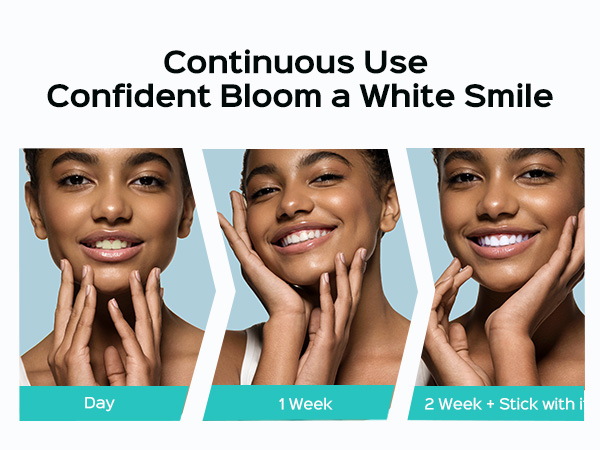 COSLUS Whitening Water Flosser Pick Portable Oral Irrigador Cordless Whitening Flossers for Teeth