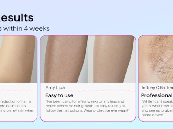 the stages of a skin care routine