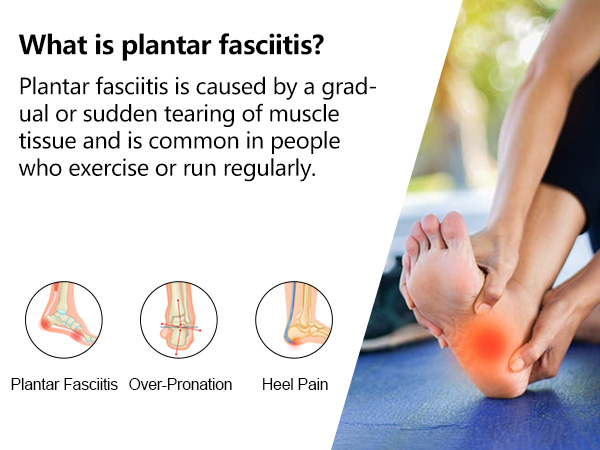 Medical diagram showing foot anatomy with three circular illustrations of plantar fasciitis, over-pronation, and heel pain, accompanied by explanatory text.