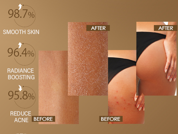 turmeric body scrub exfoliator