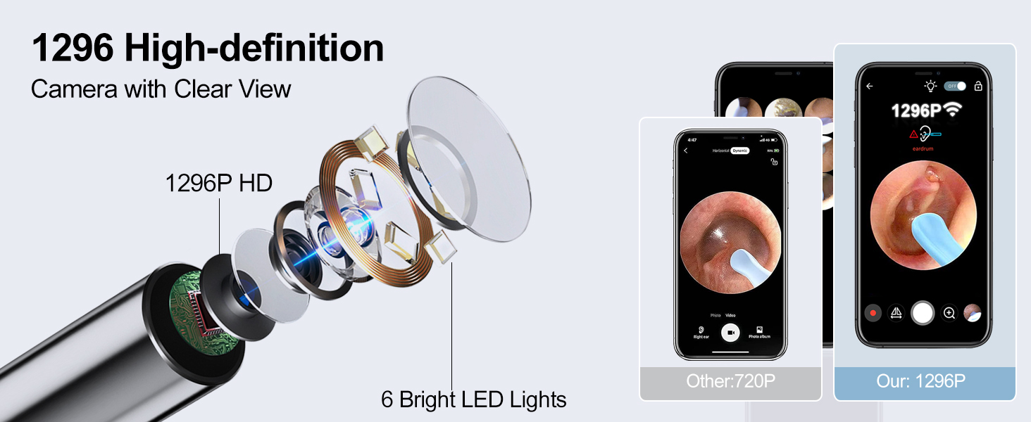 ear wax removal tool