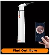 MOBI CONNECT Wi-Fi Otoscope for Ears, Nose &amp; Throat - 1080P HD Lens, Multi-Axis Gyroscope, 6 LED 