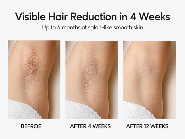 the skin care guide to visible hair reduction in 4 weeks