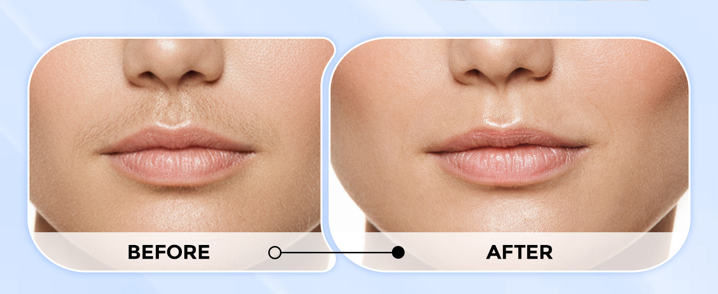 Painless Face Shaver for Women - Electric Hair Removal Device for Face Lips Peach Fuzz with Light