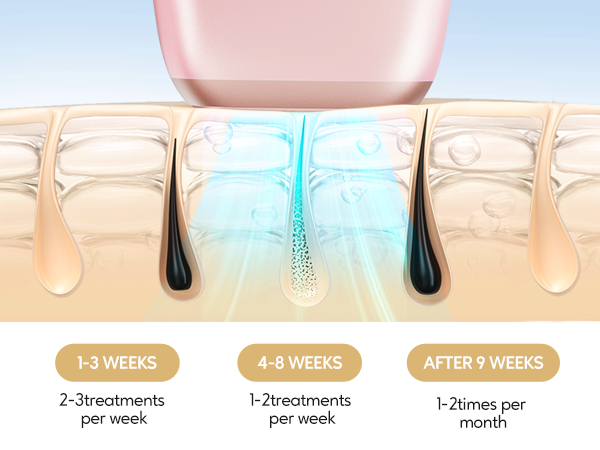 a diagram of the treatment of a botox