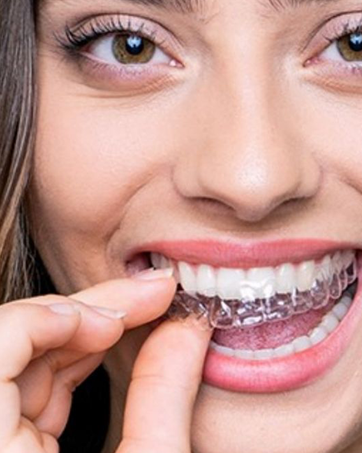 Shinchie Ultrasonic Retainer Cleaner