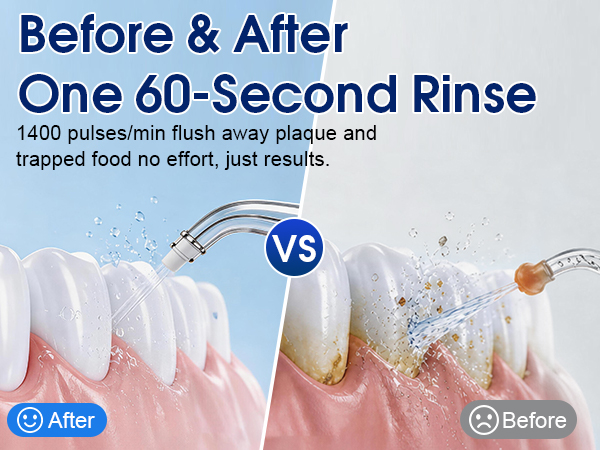 Water Flosser 