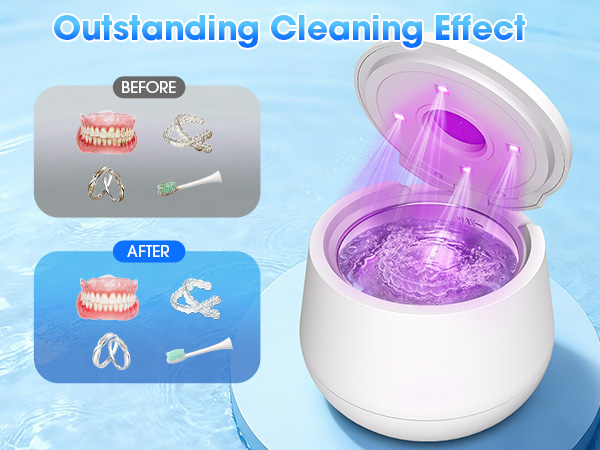 Ultrasonic Retainer Cleaner