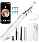 Ear Wax Removal, Ear Cleaning kit with 1296P Camera, Ear Camera with 6 LED Lights, Earwax Remover...
