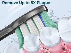 Rtauys M5 electric toothbrush