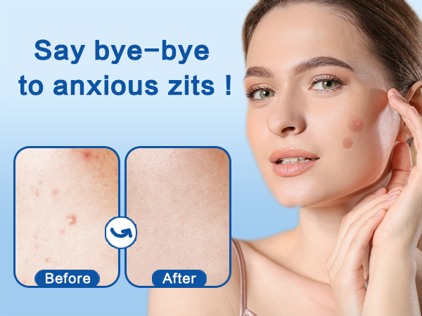 Pimple Patches for Face