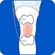 Omron TENS Pads