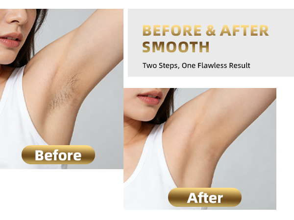 bikini trimmer