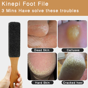 LEKESI FOOT FILE2