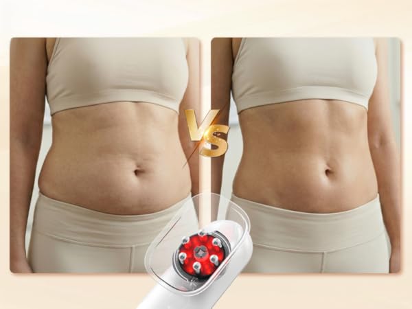 body sculpting machine for women