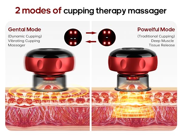 cupping