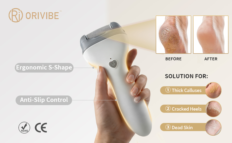 Dead Skin Remover for Feet showing Before and After results on cracked heels